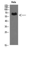 Perforin 1 Polyclonal Antibody