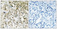 Periphilin 1 Polyclonal Antibody