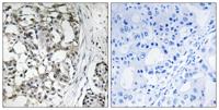 Peroxin 14 Polyclonal Antibody