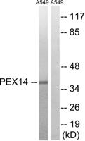 Peroxin 14 Polyclonal Antibody