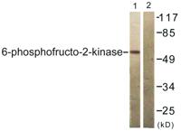 PFK-2 car Polyclonal Antibody