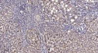 PFK-2 liv Polyclonal Antibody