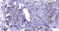 PFK-2 liv/tes Polyclonal Antibody