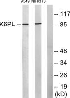 PFK-B Polyclonal Antibody