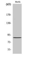 PFK-C Polyclonal Antibody