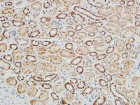 PGD Polyclonal Antibody