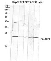 PGLYRP1 Polyclonal Antibody