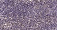 PGLYRP1 Polyclonal Antibody