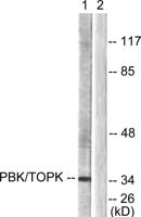 PBK Polyclonal Antibody