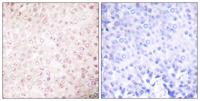 PCAF Polyclonal Antibody