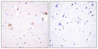 PC-PLD1 Polyclonal Antibody