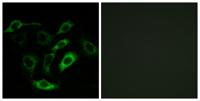 PD2R Polyclonal Antibody