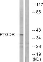 PD2R Polyclonal Antibody