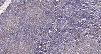 PD2R Polyclonal Antibody