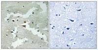 Pdcd-4 Polyclonal Antibody