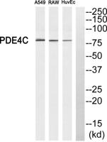 PDE4C Polyclonal Antibody