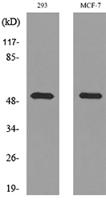 PD-ECGF Polyclonal Antibody