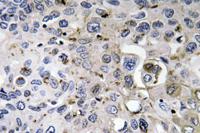 PDGF-A Polyclonal Antibody
