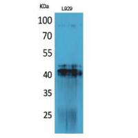 PDGF-D Polyclonal Antibody