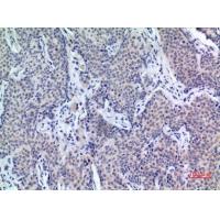 PDGF-D Polyclonal Antibody