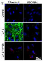 PDGFR-β Polyclonal Antibody