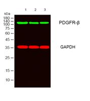 PDGFR-β Polyclonal Antibody