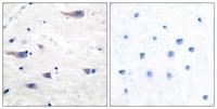 PDGFR-β Polyclonal Antibody