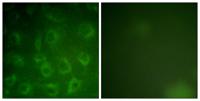 PDGFR-β Polyclonal Antibody