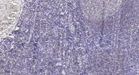 PDHA1 Polyclonal Antibody