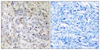 PDIK1L Polyclonal Antibody