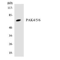 PAK4/5/6 Polyclonal Antibody