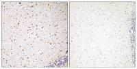 PAK5 Polyclonal Antibody