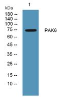 PAK6 Polyclonal Antibody