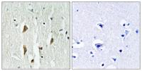 PAKα/β/γ Polyclonal Antibody