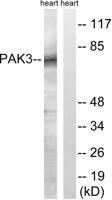 PAKβ Polyclonal Antibody