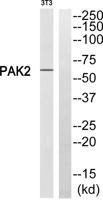 PAKγ Polyclonal Antibody