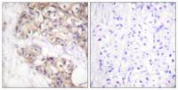 PAKγ Polyclonal Antibody