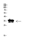 Pan myristoylation  Polyclonal Antibody