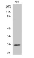 Rho GDIγ Polyclonal Antibody