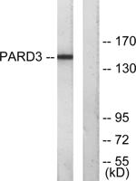 PARD3A Polyclonal Antibody