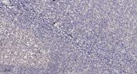 PARD3A Polyclonal Antibody