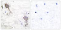 PARK2 Polyclonal Antibody