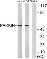 Parkin Polyclonal Antibody