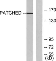 Patched Polyclonal Antibody