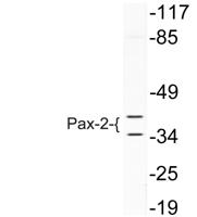 Pax-2 Polyclonal Antibody