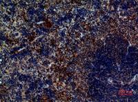 Pax-5 Polyclonal Antibody