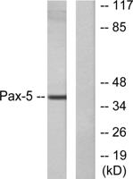 Pax-5 Polyclonal Antibody