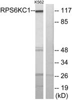 p52 S6 kinase Polyclonal Antibody