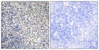 p53AIP1 Polyclonal Antibody