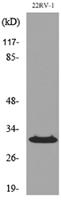 p57 Polyclonal Antibody